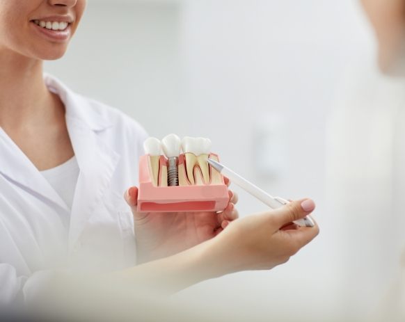 Dentist using model to explain dental implants