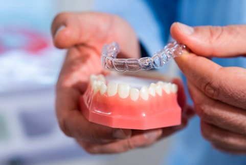 Dentist placing Invisalign aligner over model of teeth