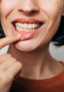 a woman showing her gums near East Petersburg