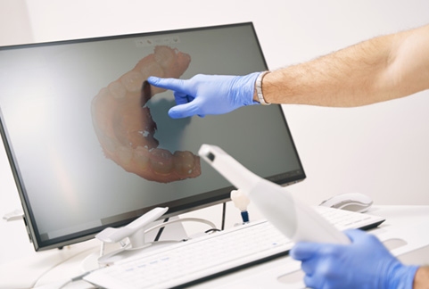 Gloved hands holding digital impression scanner and pointing at computer monitor