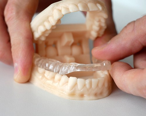 An occlusal splint